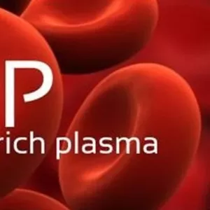 (  PRP,  platelet-rich plasma),   Плазмолифтинг в Кишиневе,  Молдове! В к
