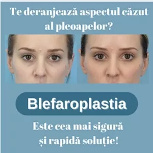 Operația de blefaroplastie superioară 