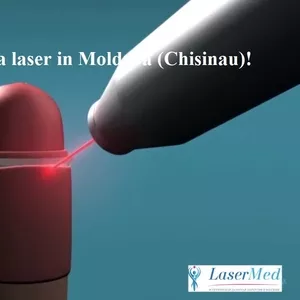 Frenotomia,  Frenoplastia laser in Moldova (Chisinau)!