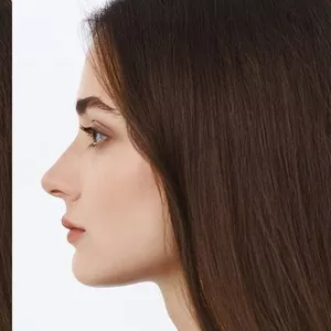 Remodelare corporala prin lipoliza asistata laser in Moldova!